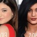 Kylie Jenner Finally Admits The Truth About Her Lips